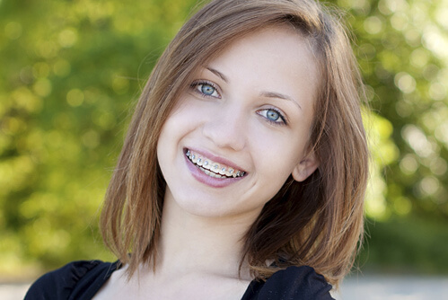 Orthodontics for Teens link