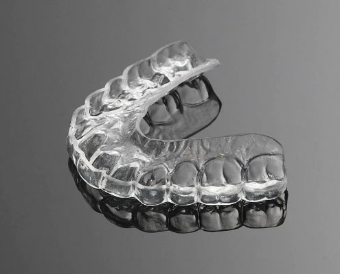 Clear Aligners
